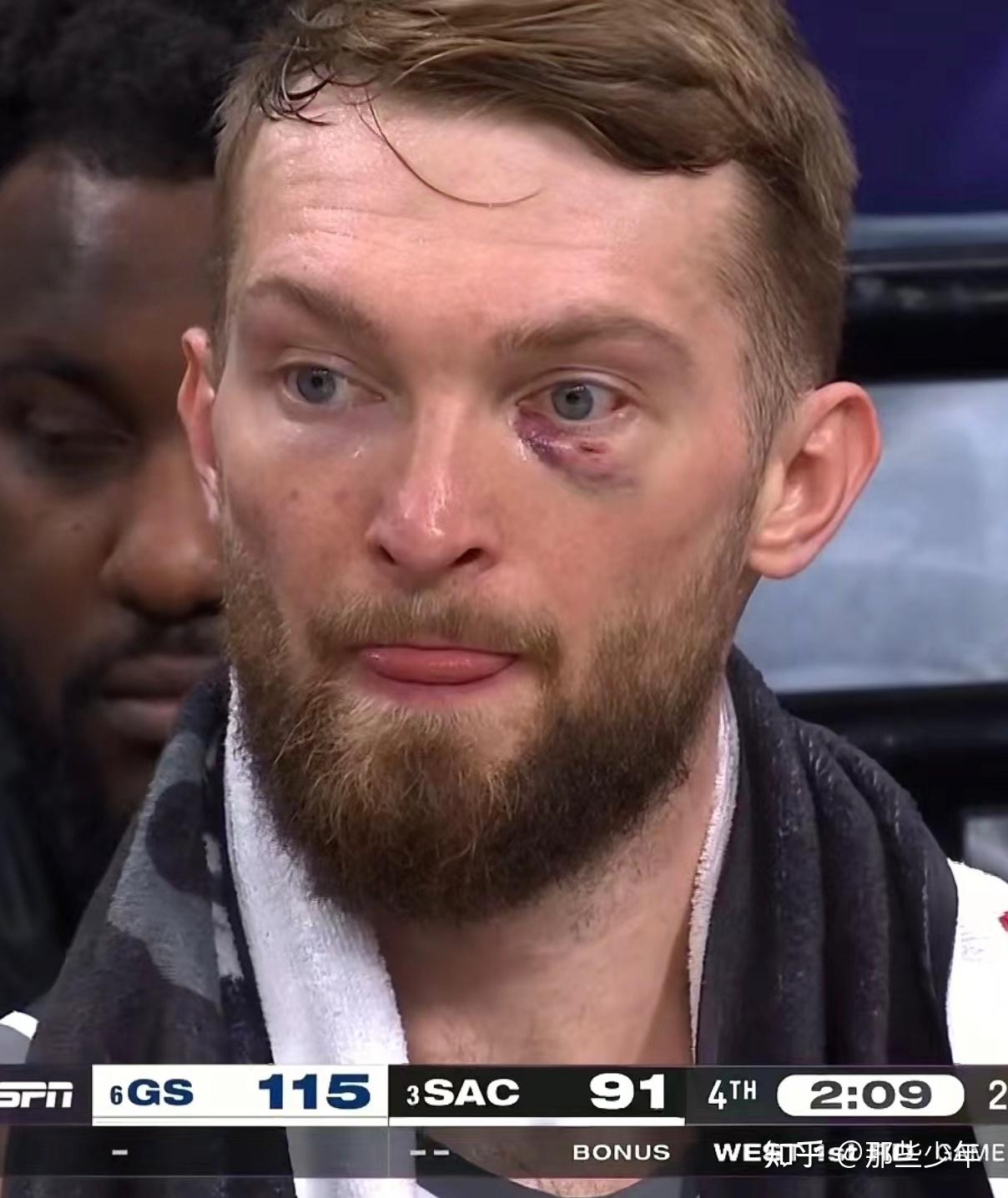 开云APP包含萨克拉门托国王冲刺阶段完成体检赛后葡萄牙体育调整名单以备NBA季后赛,网友:马赛围绕西甲造点机会的词条